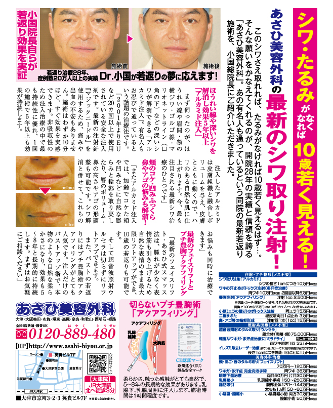 photo1